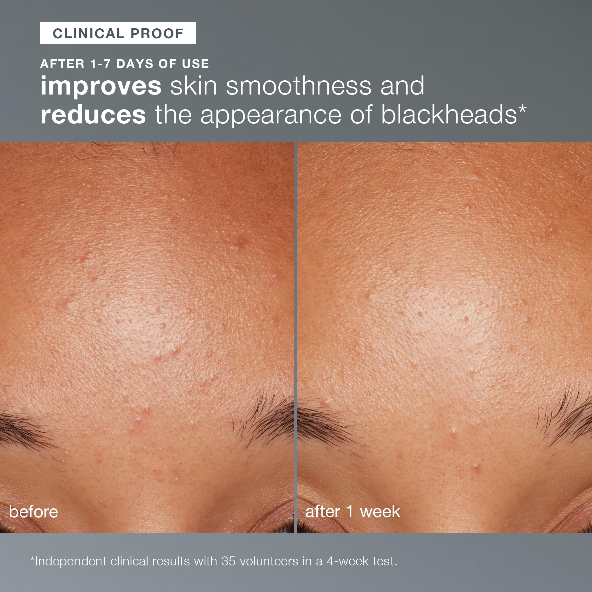 daily microfoliant exfoliator clinical