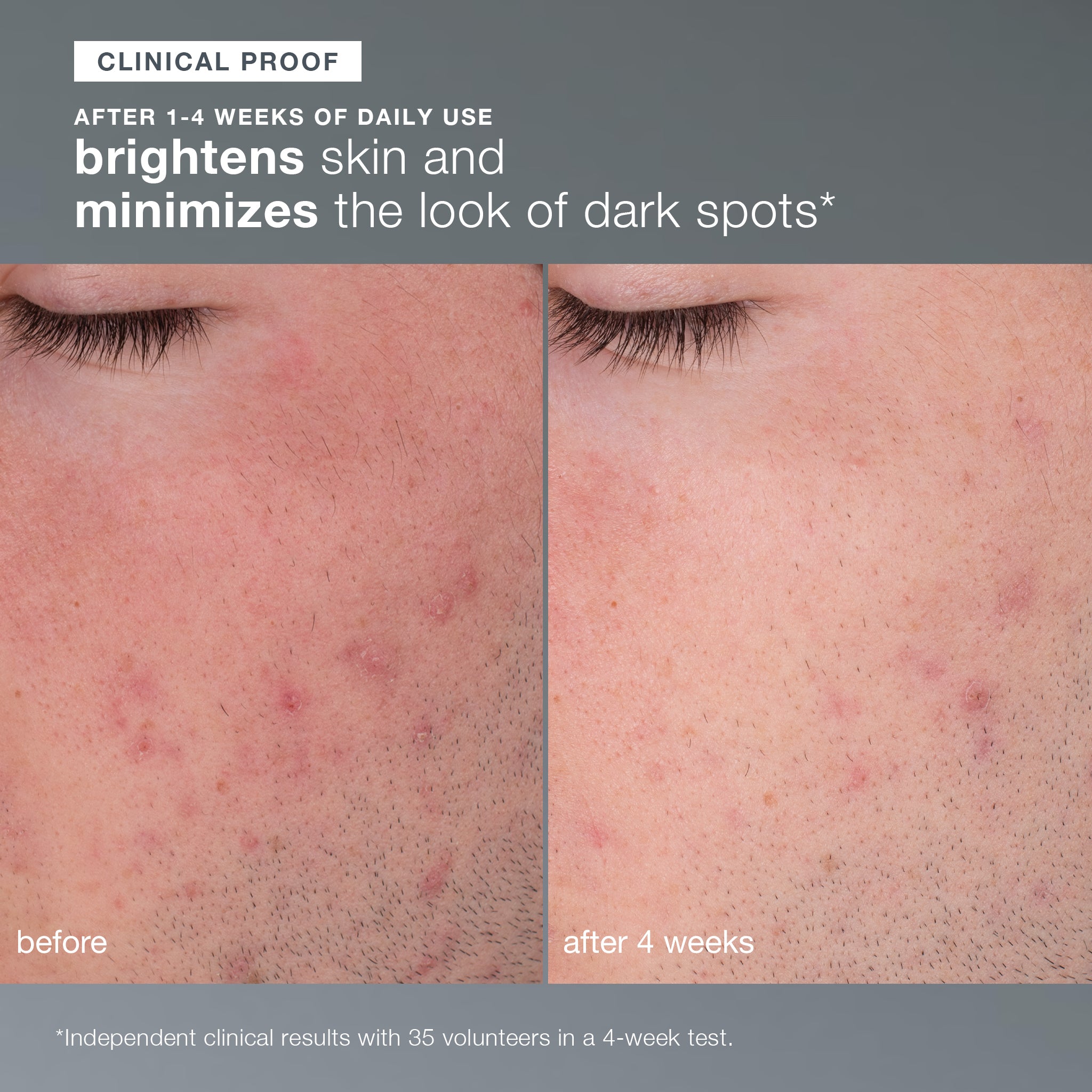 daily microfoliant exfoliator clinical